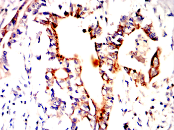 TSPO Antibody