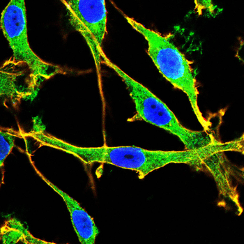 MMP12 Antibody