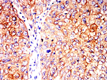 VCAM1 Antibody