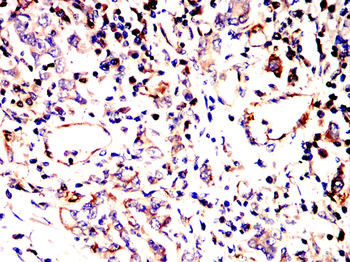 VCAM1 Antibody
