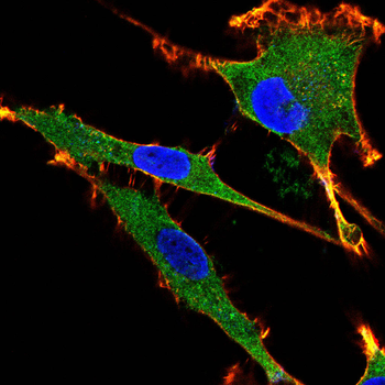 Collagen X Rabbit Polyclonal Antibody