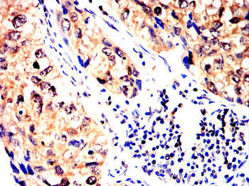 Collagen X Rabbit Polyclonal Antibody