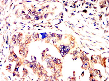 Collagen X Rabbit Polyclonal Antibody