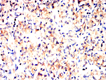 Collagen X Rabbit Polyclonal Antibody