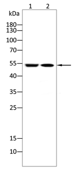 Vimentin Rabbit Polyclonal Antibody