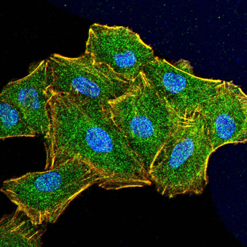Vimentin Rabbit Polyclonal Antibody