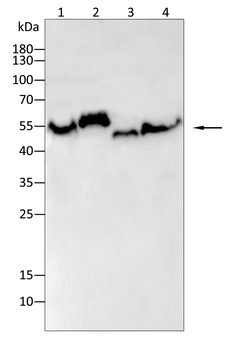 Vimentin Rabbit Polyclonal Antibody