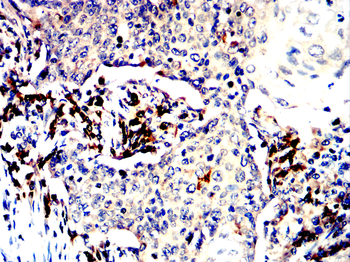 CD81 Antibody