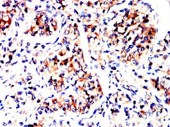 CD81 Antibody