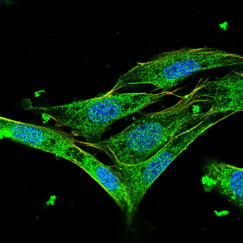 CALB2 Antibody