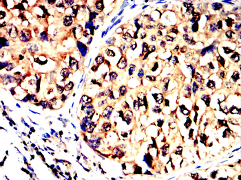 CALB2 Antibody