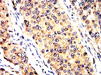CALB2 Antibody