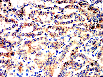 CALB2 Antibody