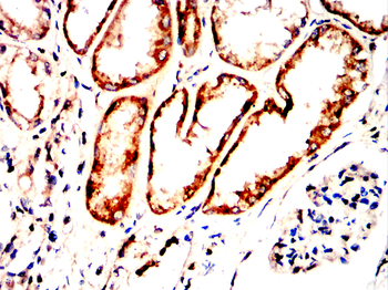 TLR2 Antibody