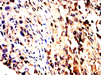 TLR2 Antibody