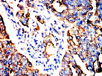 MUC1 Antibody