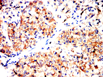 CD274 Antibody