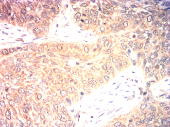 CDKN2A Antibody