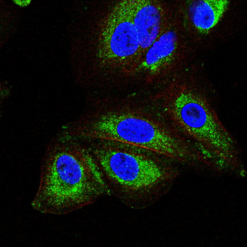 HK2 Antibody