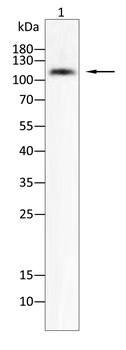 HK2 Antibody