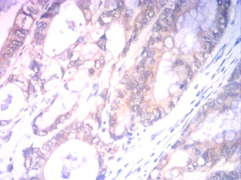 ASS1 Antibody