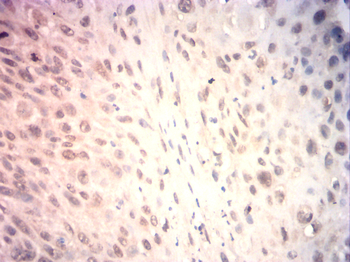 EMD Antibody