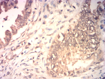 EMD Antibody