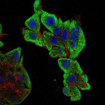 ILK Antibody