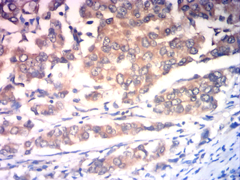 ILK Antibody