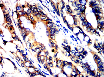 ILK Antibody