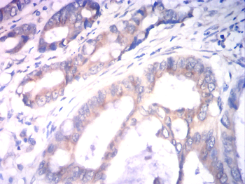 ILK Antibody