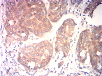 ILK Antibody