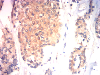 ILK Antibody