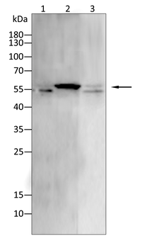 ILK Antibody