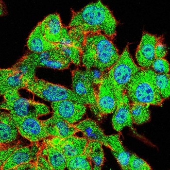 NTRK1 Antibody