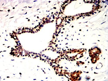 DNMT1 Antibody