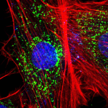 SDC1 Antibody
