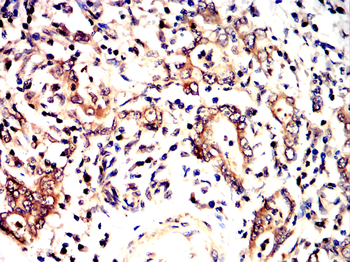 BMPR2 Antibody
