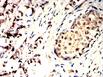 ACP5 Antibody