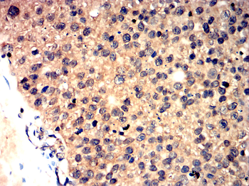 ACP5 Antibody