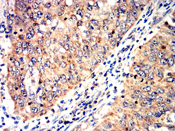 ACP5 Antibody