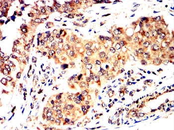 ACP5 Antibody