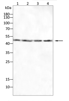 ACP5 Antibody
