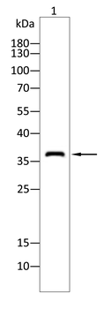 ACP5 Antibody