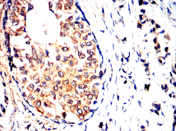 DDR2 Antibody