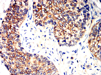 DDR2 Antibody