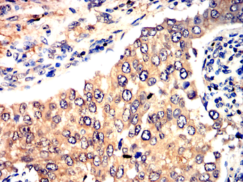 DDR2 Antibody