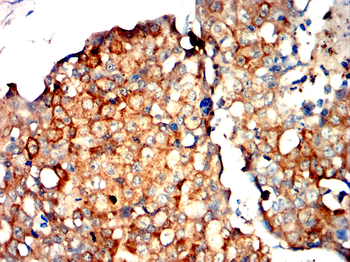 NME1 Antibody