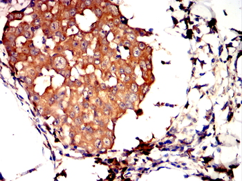 TNFSF11 Antibody