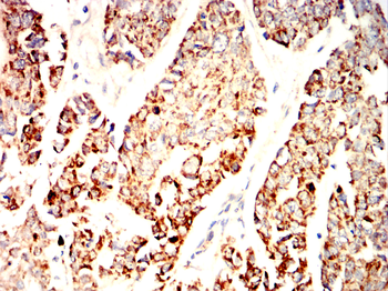 ALDH2 Antibody